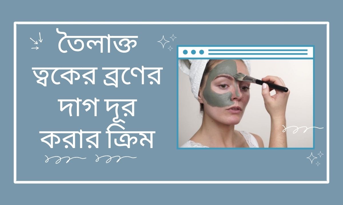 তৈলাক্ত ত্বকের ব্রণের দাগ দূর করার ক্রিম