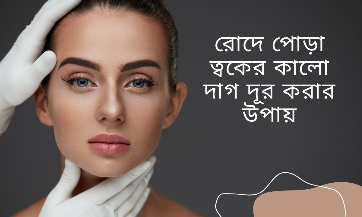 রোদে পোড়া ত্বকের কালো দাগ দূর করার উপায়